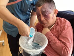 染料をハンカチに垂らしているのを眺めている利用者さんの写真